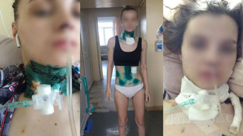 Резал ножом на глазах у дочки: алматинка жила сразу с двумя мужчинами