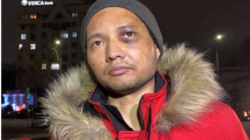 Испытал жесточайшие пытки в январе: музыкант Рузахунов намерен добиваться от Казахстана компенсации