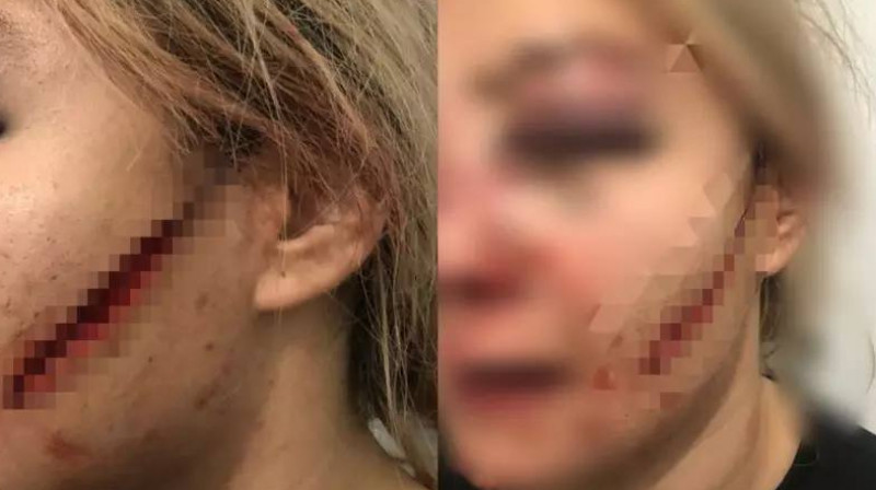 Талғарда қыз баланы жақын танысы аяусыз соққыға жықты