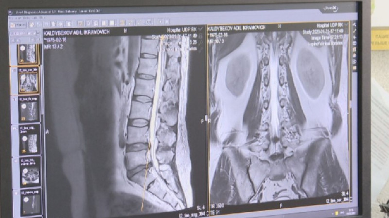 Платформу для распознания инсульта разработал павлодарец
