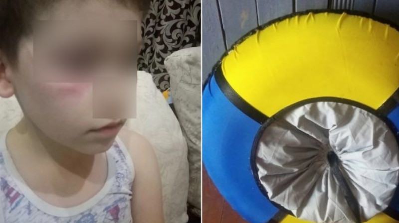 В России ребенка избили и назвали «украинцем» из-за «ватрушки»