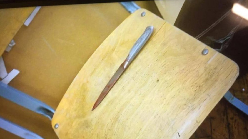 11-летняя школьница нанесла однокласснице десятки ножевых ранений в лицо и тело