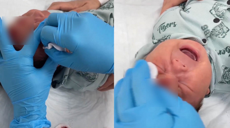 Лезвием по лбу ребенка: Минздрав намерен подать в суд на центр