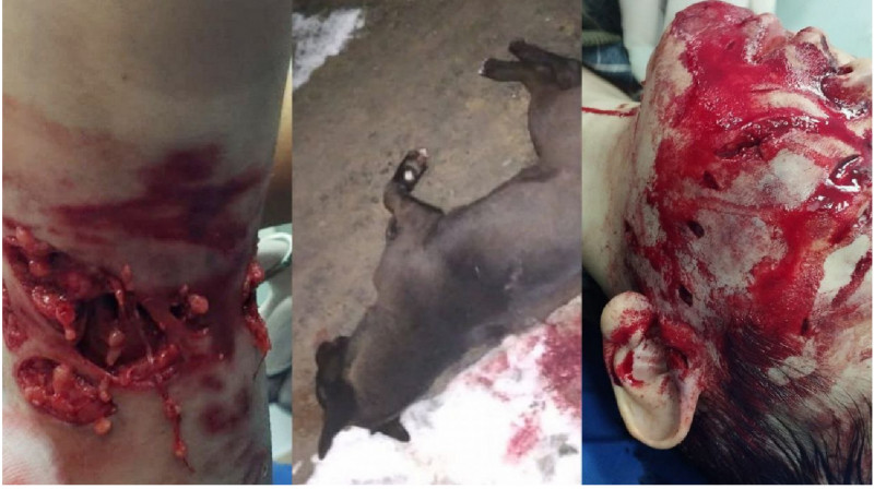 Шокирующие фото ребенка, попавшего в реанимацию после нападения собаки в Атырау (+18)