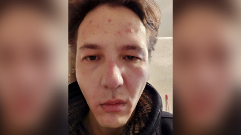 Журналист Данияр Молдабеков сообщил о нападении