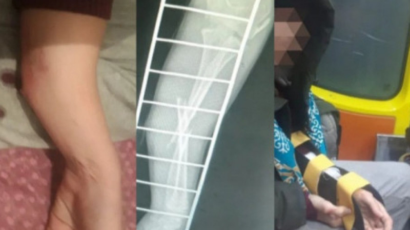 Таразда жасөсіпірм екі қолмен амандаспаған оқушының қолын сындырды