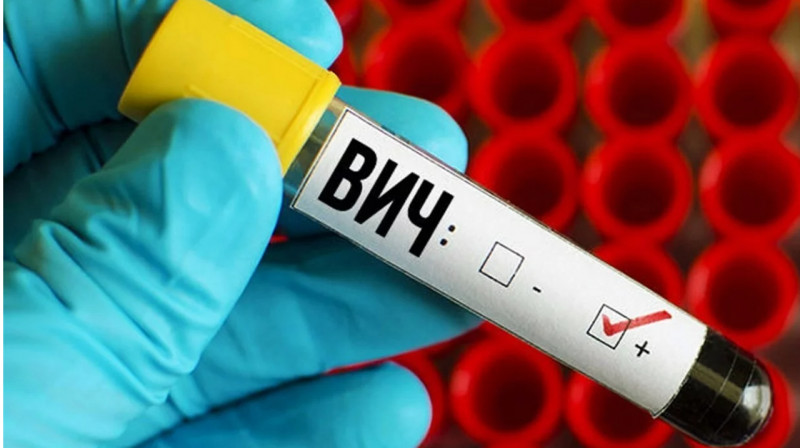 Шымкентте 646 ВИЧ жұқтырған әйел өмірге дені сау ұрпақ әкелген