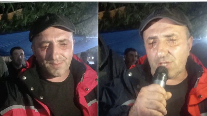 Протесты горняков в Грузии: один из шахтеров зашил себе глаза