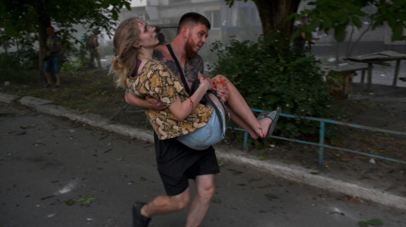 80 человек пострадали в результате российского обстрела в Донецкой области