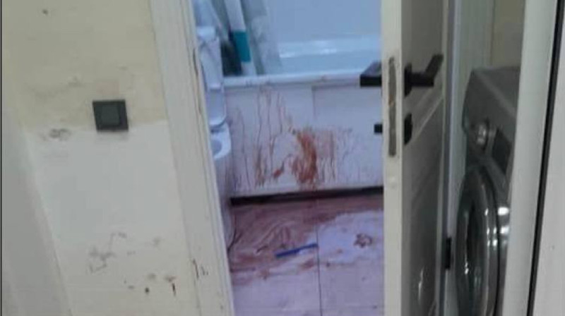 Кыргызстанец отрезал жене уши и нос из-за ревности