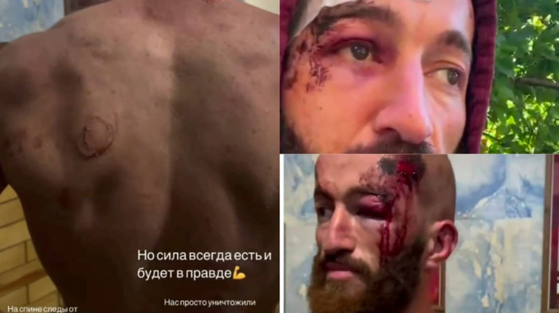 «Россия - для русских» - на оккупированной украинской территории мобилизованного осетина избили российские военные полицейские