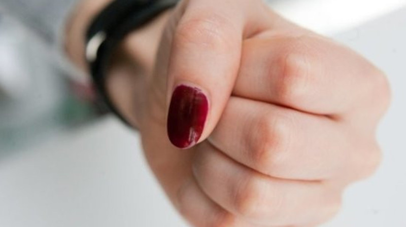 "Поругалась с рентгенологом и разбила ему череп": пациентку подозревают в избиении врача в России