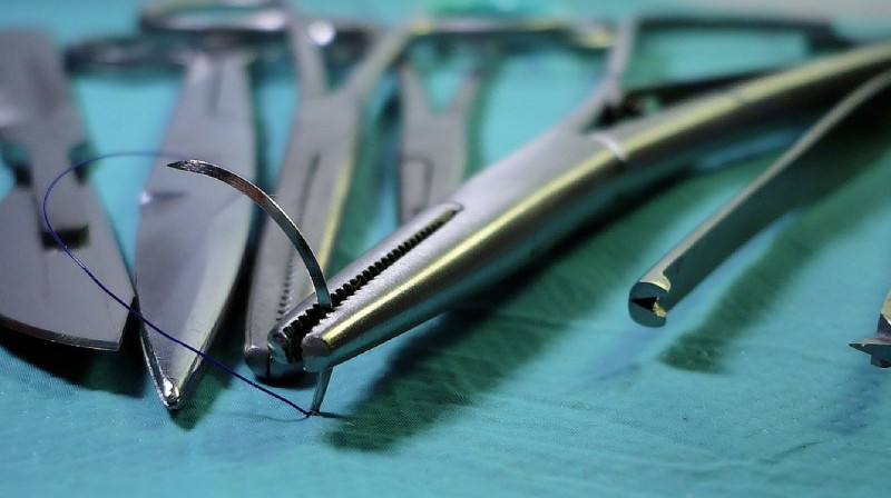 Врачи вырезали почки без согласия пациентов в Пакистане