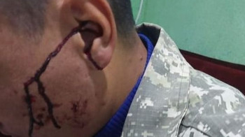Нападение на лесника в Иле-Алатауском нацпарке: полиция устанавливает подозреваемых