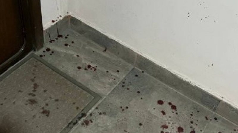 Женщину избили в подъезде в России