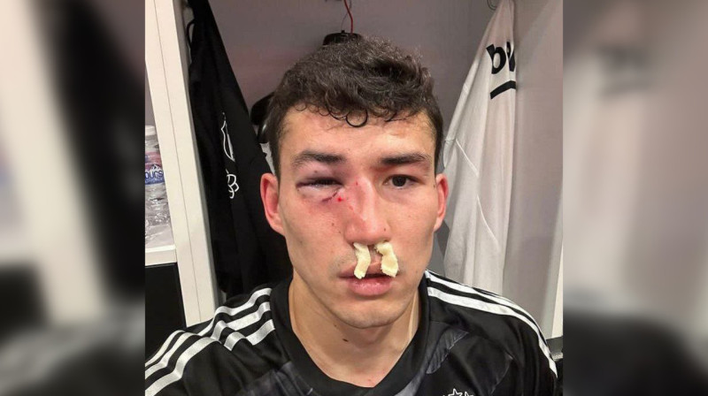 Зайнутдинову разбили лицо перед решающими матчами сборной Казахстана в отборе Евро-2024