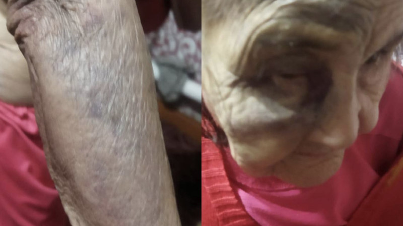Женщины жестоко избили бабушку в Костанае
