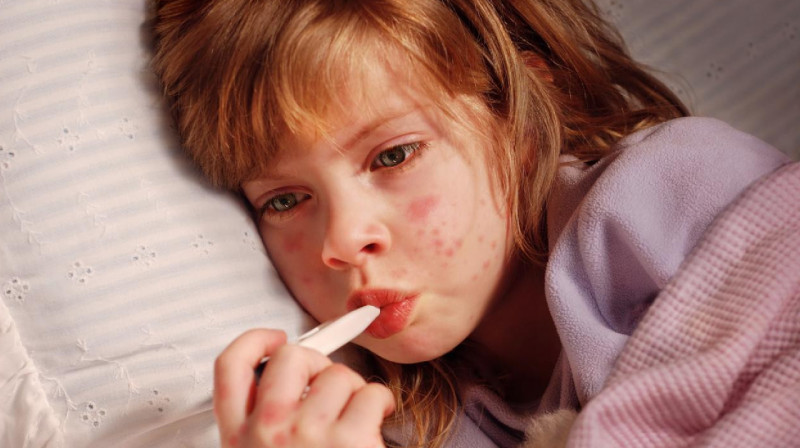 В ЗКО вспышка скарлатины в детсаду, сообщают о летальном исходе