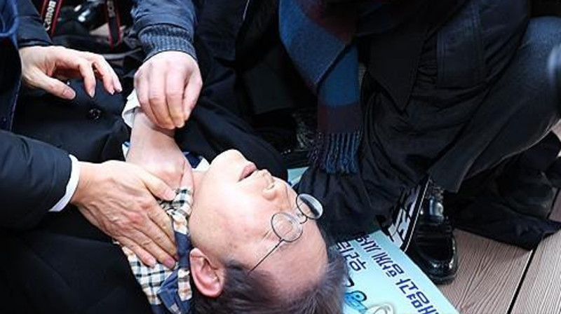 Пострадавшему от покушения на убийство лидеру южнокорейской оппозиции провели операцию