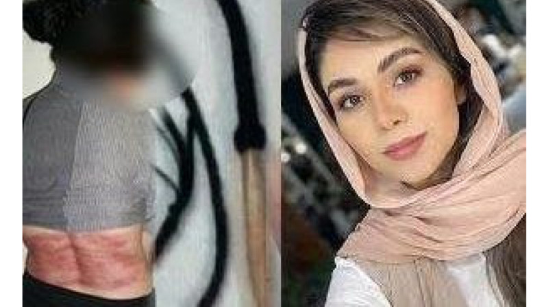 Иранка получила 74 удара плетью за отказ носить хиджаб