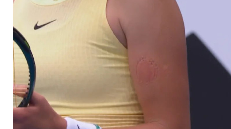 Оғаш қылық: Ресейлік теннисші Australian Open матчында өзін-өзі тістеп алды