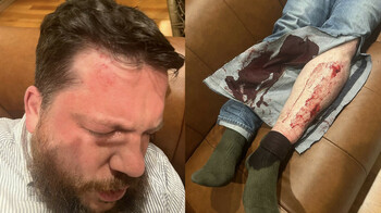 В Вильнюсе напали на соратника Навального