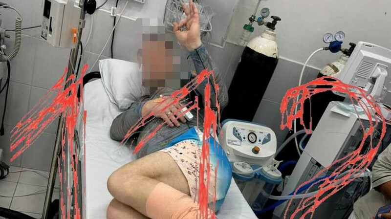 Акула напала на россиянина на Мальдивах