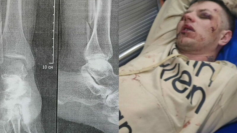 В Ростове избили военного из-за того, что он воевал за «Вагнер»