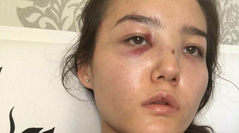 Супруга советника посольства Казахстана в ОАЭ рассказала подробности о насилии со стороны мужа