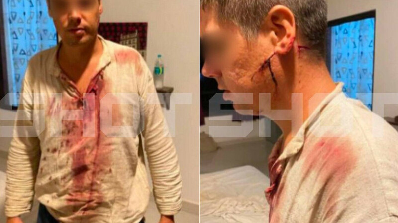 В Гоа напали на туристов из Казани: мужчину ранили мачете